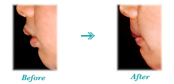 ��{�O�ˉ��i�o�����j�摜