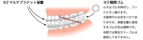 �{�ԃS���摜