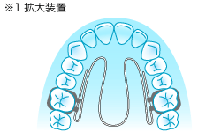 �g�呕�u�摜