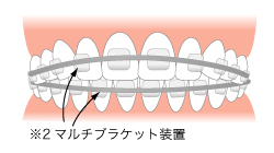 �}���`�u���P�b�g���u�摜